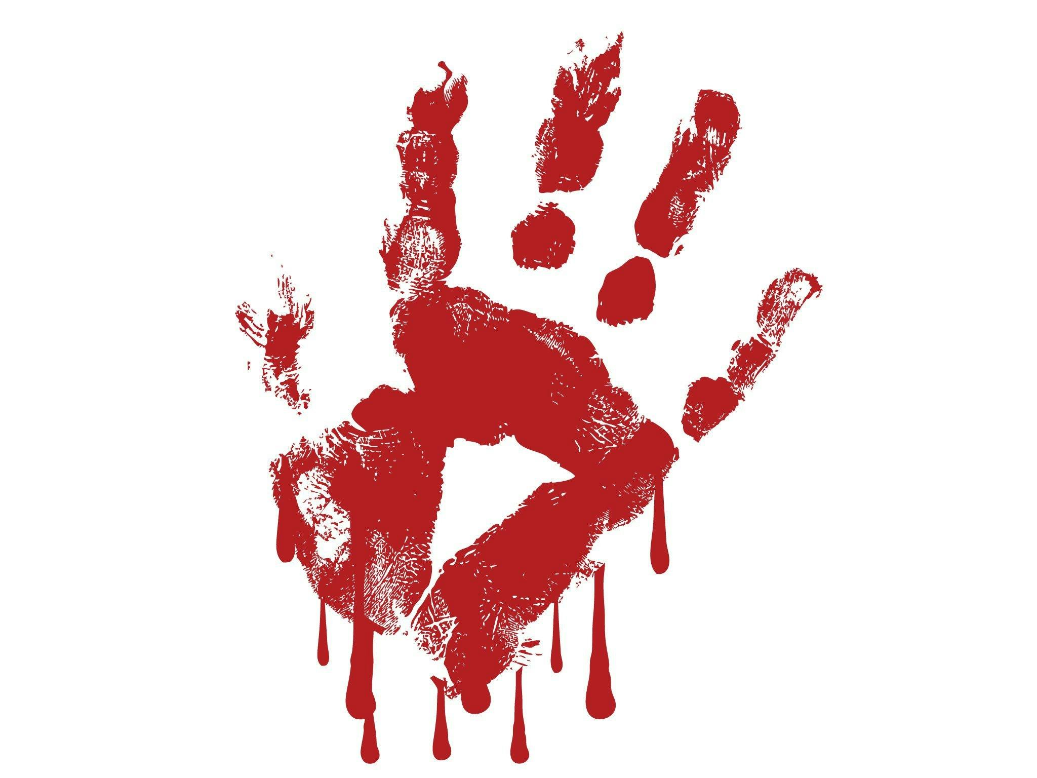 is the blood on your hands?