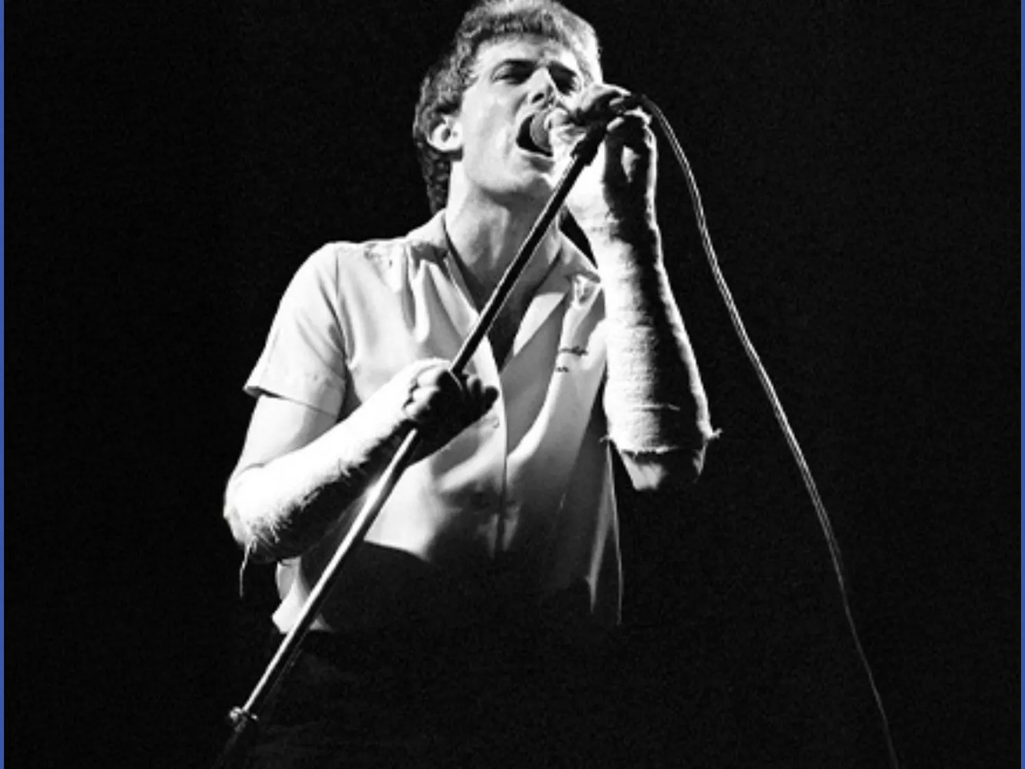 A young James Reyne with 2 broken arms singing into a microphone