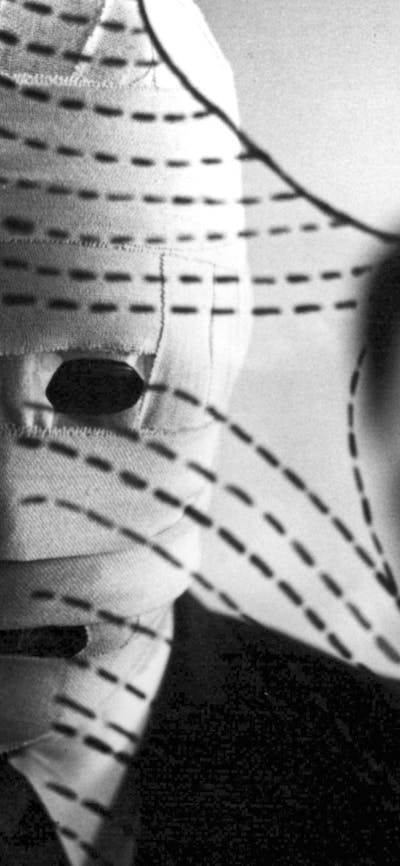 Black and white image of man with face covered in bandages