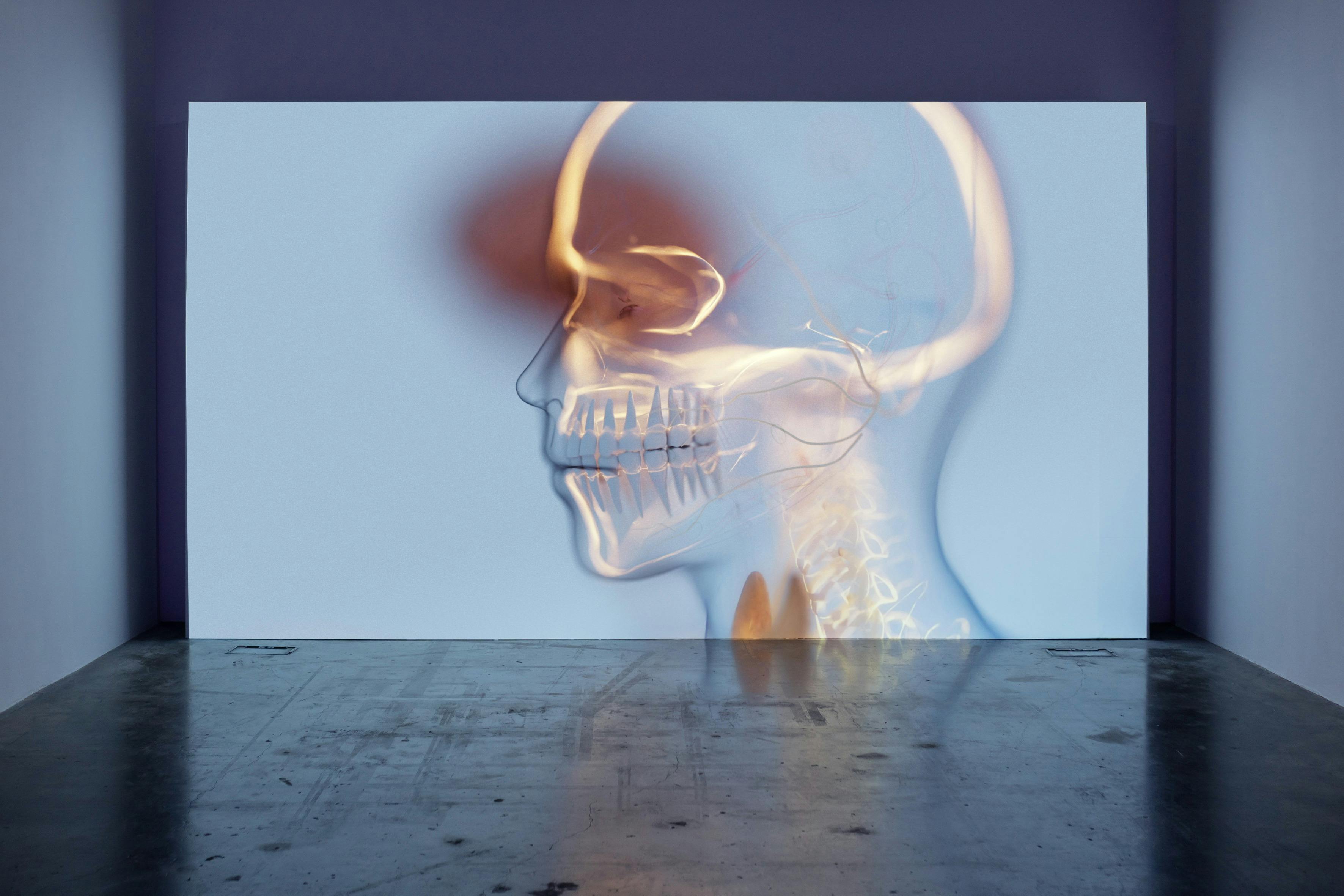 Video of a human skull and brain.
