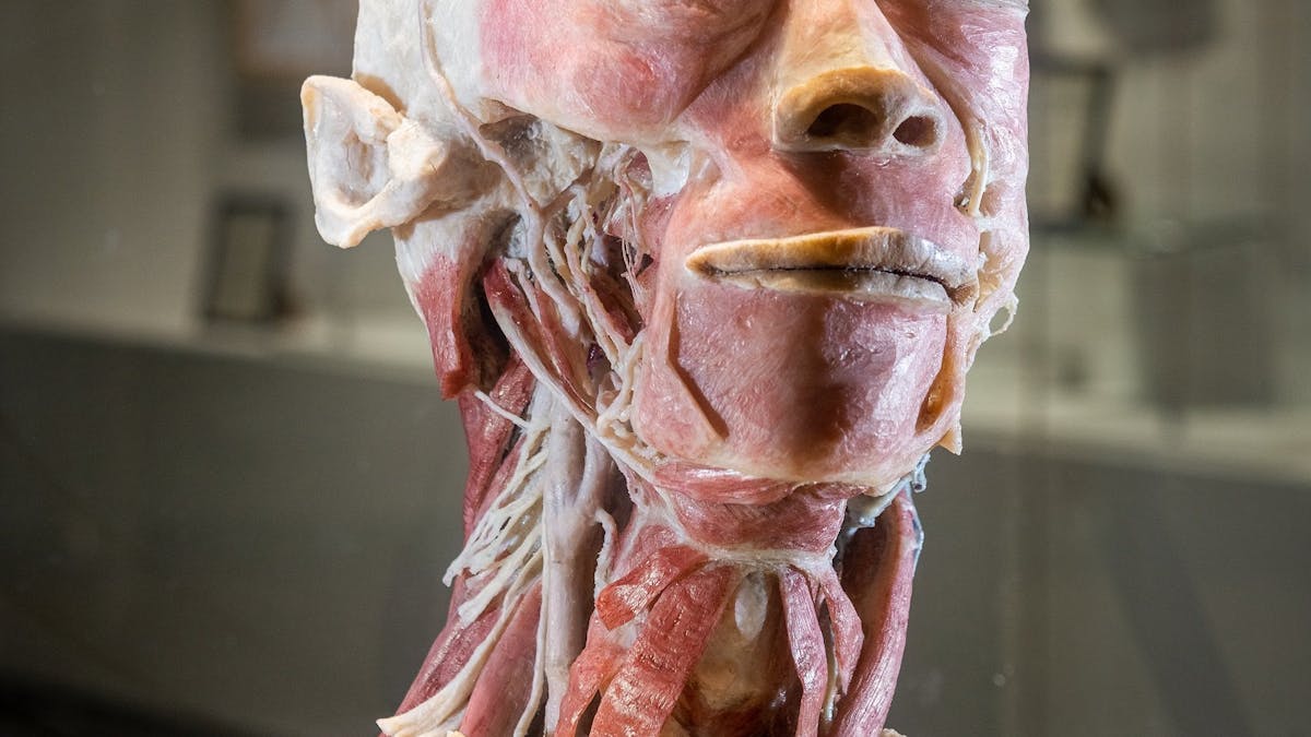 Sculpture - The Real Human Anatomy Exhibition