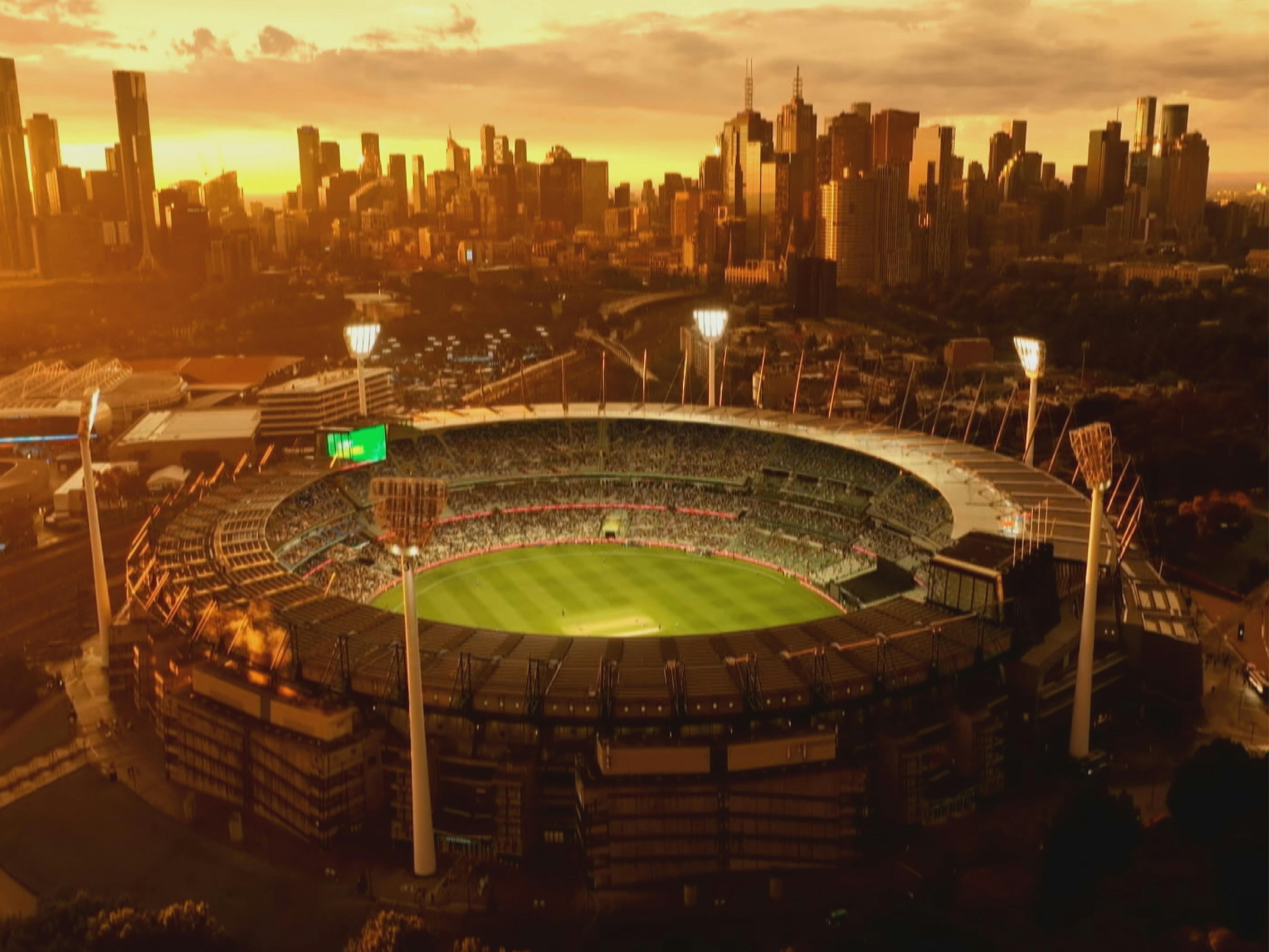 MCG