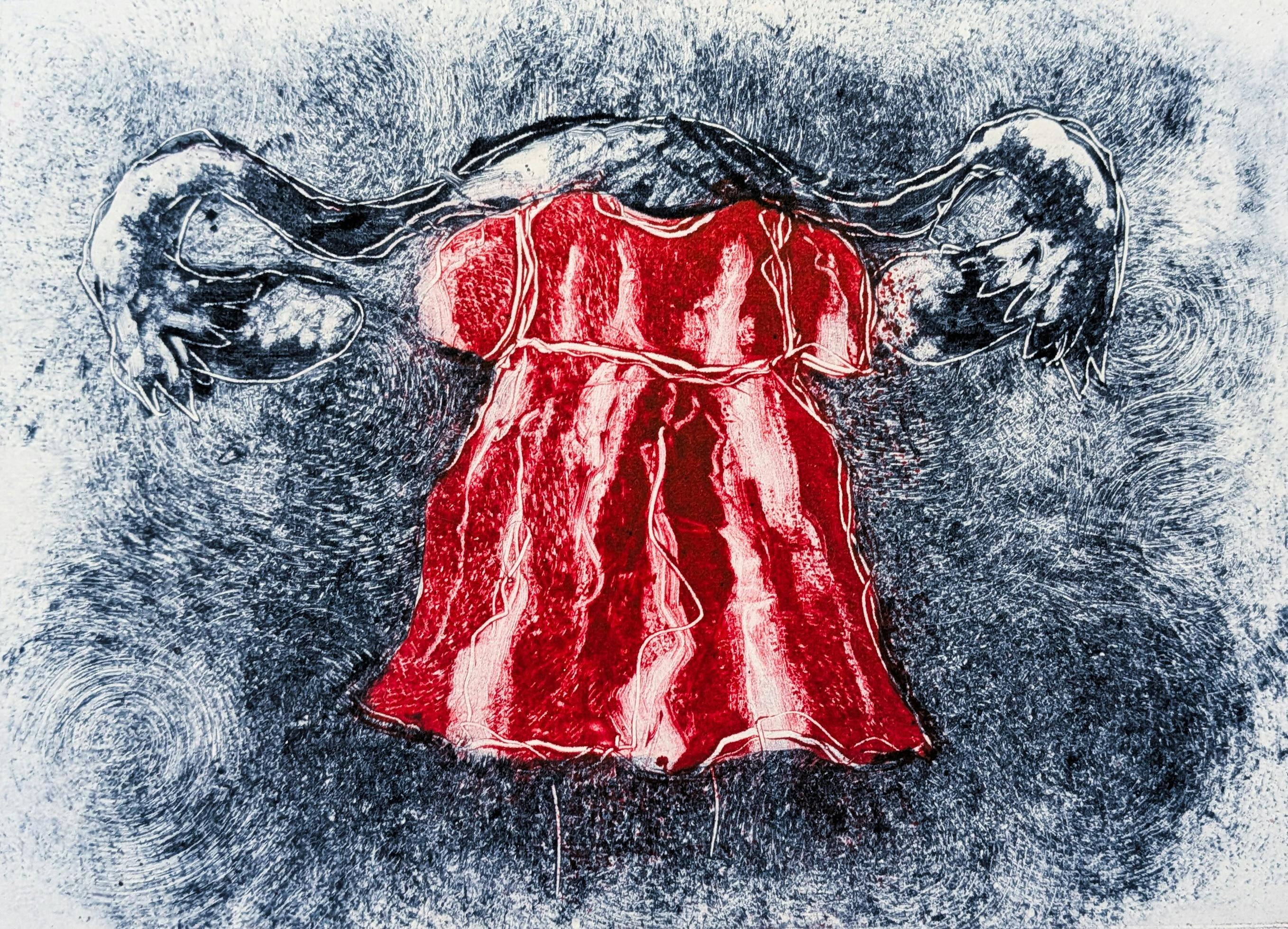 Printmaking-style artwork depicting a vivid red dress-like form suspended between two ovaries.