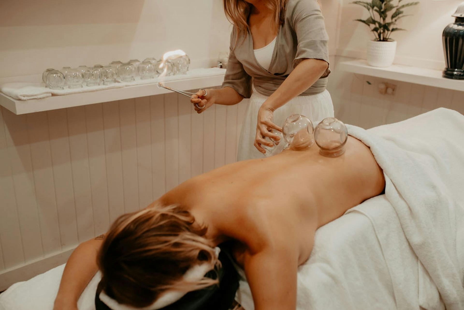 Acupuncturist applies cups using the traditional fire method to a patient's lower-back