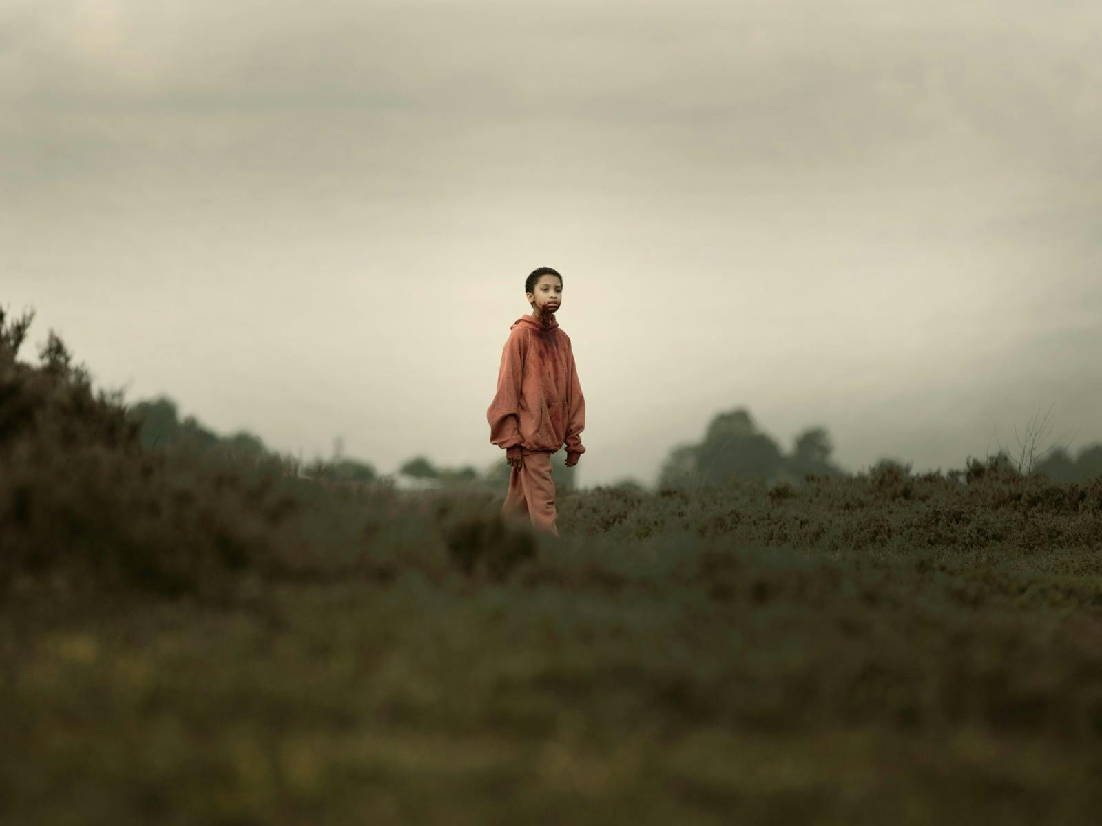 Young child with shaved head stands in isolated surrounds with blood around mouth
