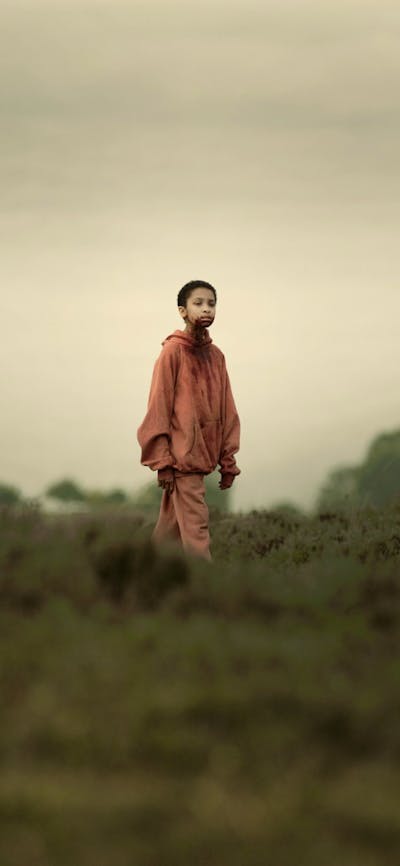 Young child with shaved head stands in isolated surrounds with blood around mouth
